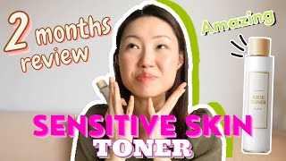 IM From Rice Toner Before And After  2 months Honest Review for Sensitive Acne Prone Skin [upl. by Lienaj]