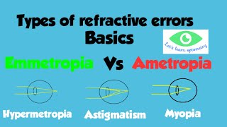 Emmetropia amp Ametropia Different types of refractive errorsMyopia HypermetropiaAstigmatism [upl. by Nirihs]