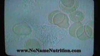 Live blood cell analysis part 2 Dr Chambers [upl. by Lomaj]