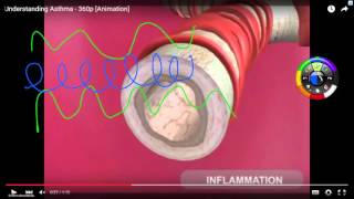 Asthma Pathophysiology and medications [upl. by Attekahs305]