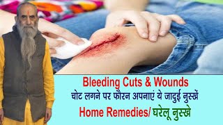 चोट लगने पर फौरन अपनाएं ये उपचार  Bleeding Cuts amp Wounds  Home Remedies [upl. by Enaira]