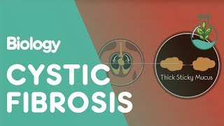 What Is Cystic Fibrosis  Health  Biology  FuseSchool [upl. by Anilocin828]