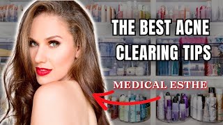 MY BEST CLEAR SKIN TIPS ALL IN ONE VIDEO everything Ive learned in 15 years [upl. by Anhpad]