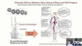 Autoimmune neuropsychiatric disorders The science and case studies [upl. by Neelrad657]