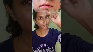 Reequil Ceramide and hyaluronic acid moisturizer Malayalam reviewmoisturizer for dry skin 🫡myntra [upl. by Simons]