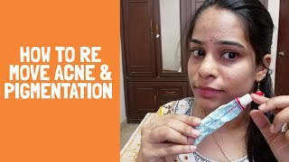 How this Ointment Works 100 Spotless Glowing Skin in Telugu  Remove Pigmentation just in Week [upl. by Tneciv]