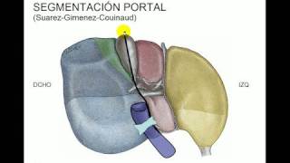 Segmentacion hepática [upl. by Ilenna572]