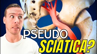 Do You Have FAKE Sciatica Herniated Disc vs Muscle Pain [upl. by Jemmy48]