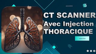 CT Scanner THORACIQUE Avec Injection  Partage de Pratiques [upl. by Etti]