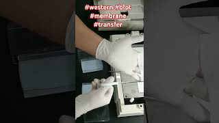 western blot membrane transfer [upl. by Nilad779]