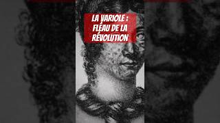 La VARIOLE durant la Révolution française short [upl. by Cirederf382]