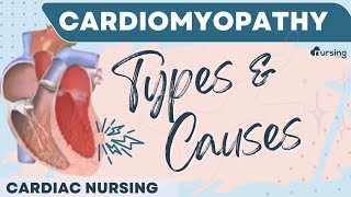 Cardiomyopathy Types and Causes Cardiac Nursing [upl. by Hellah]