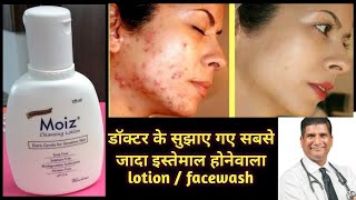 Moiz cleansing lotion  moiz cleanser for sensitive skin  best facewash acne pimples dryskin [upl. by Enotna423]