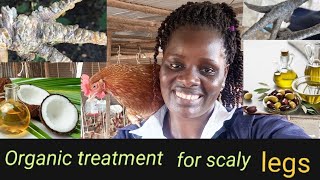 DONT BUY CHICKEN MEDICINE AGAIN How to treat scaly legs organically in poultry farming 🙏 [upl. by Telrahc]