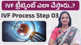 IVF ట్రీట్మెంట్ అంటే ఏమిటి3IVF PROCESS STEP BY STEPIVF CARE Fertilica IVF [upl. by Kelvin]