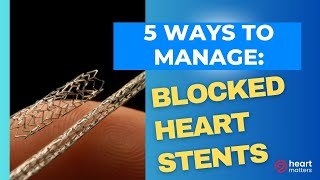 5 ways to manage blocked heart stents [upl. by Alage]