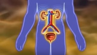 Kidney Stones Causes and Symptoms ENG SUB [upl. by Francyne873]