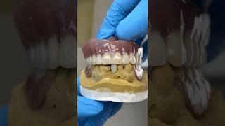 Process Denture and Partial lsk121shorts dentist teeth [upl. by Jilli228]