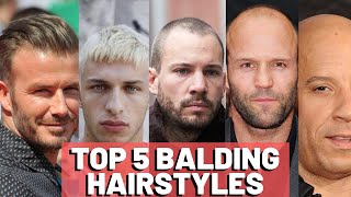 Hairstyles For Balding Men  Our TOP 5 [upl. by Yrannav]