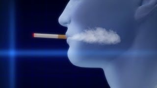 Electric cigarette explodes in mans mouth [upl. by Bollen]