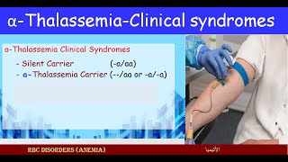 Lecture 251 Carriers alfa Thalassemia  Clinical Syndromes [upl. by Nov]