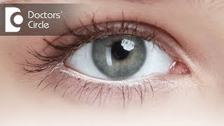 What are the different types of glaucoma  Dr Sirish Nelivigi [upl. by Anala]