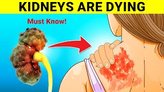 9 Warning Signs Your Kidneys Are Failing  Tests to Avoid Dialysis [upl. by Edlyn]