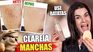 CASCA DE BATATA CLAREIA MANCHAS DE PELE Inclusive Melasma [upl. by Crawford940]