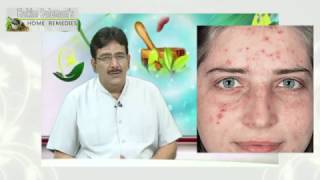 Cure Skin Problems with Baking Soda  Hakim Suleman Khan खाने वाले सोडा से दूर करें चर्म रोग [upl. by Inga894]