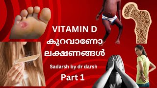 VitaminD deficiency Malayalam  less vitamind vitamind hairfallbody pain [upl. by Romito964]