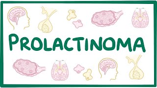 Prolactinoma  causes symptoms diagnosis treatment pathology [upl. by Kristoforo780]