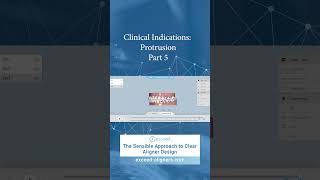 Clinical Indications Protrusion Part 5 [upl. by Immas]