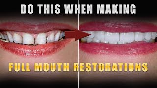 Do This When Making Full Mouth Restorations [upl. by Clemence]