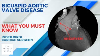 Why is Bicuspid Valve Disease Different [upl. by Inah]