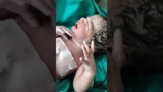 Ohh my god 😮😮newbornbaby cutebaby childbirth tranding viralvideo [upl. by Sollows907]