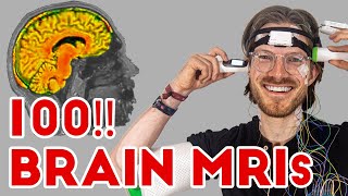 This mad scientist scanned his brain over 100 times [upl. by Nujra9]