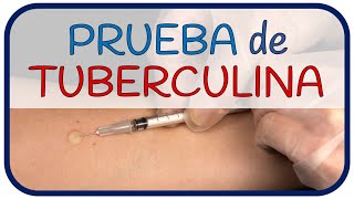 PRUEBA DE TUBERCULINA  ¿Cómo se realiza [upl. by Shelagh]