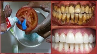 ✅ Truco Magico Para limpiar tus dientes en pocos minutos [upl. by Eioj8]