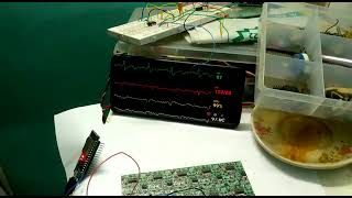 How to make your own Patient Multipara monitor  DIY ECG SPO2 BP MONITOR  For help subscribe [upl. by Silliw]