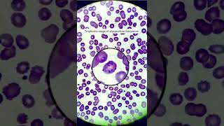 Malaria parasite under microscope trophozite of plasmodium falciparum microscopyparasitology [upl. by Nosnevets599]