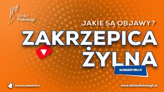 ZAKRZEPICA ŻYLNA  jakie są jej objawy [upl. by Adekam]