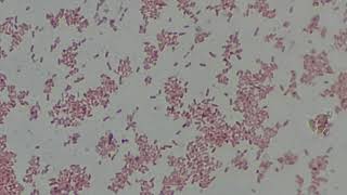 Klebsiella pneumoniae Gram stained Footages under the Microscope Gram Negative Bacteria [upl. by Ellenehc]