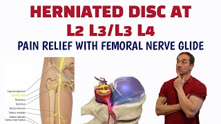 Femoral Nerve Glide For A Lumbar Herniated Disc [upl. by Tiphany]