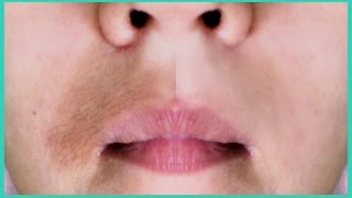 ELIMINA Y ACLARA EL BIGOTE EN 5 MINUTOS NATURALMENTE  Te encantará [upl. by Kantor]