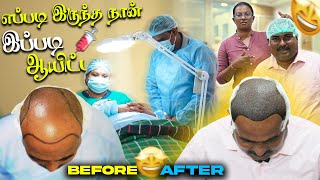 சம்பத்கான் கு முடி நட்டாச்சு  Hair Plantation  WFT Vlog [upl. by Adnohsirk]