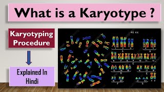 Karyotype  What is a Karyotype and how is it done [upl. by Norma]