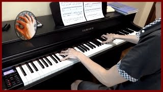 Shigatsu wa Kimi no Uso  Otouto Mitai na Sonzai Piano  Sheet Music [upl. by Per]