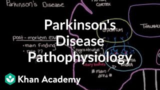 Putting it all together  Pathophysiology of Parkinsons disease  NCLEXRN  Khan Academy [upl. by Abba327]