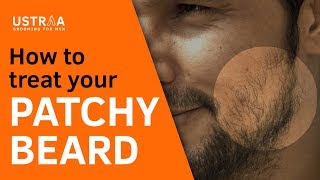 How To Treat A Patchy Beard [upl. by Vacuva677]