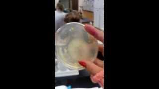 Fungi and bacteria in the Petri dish [upl. by Nosnek]